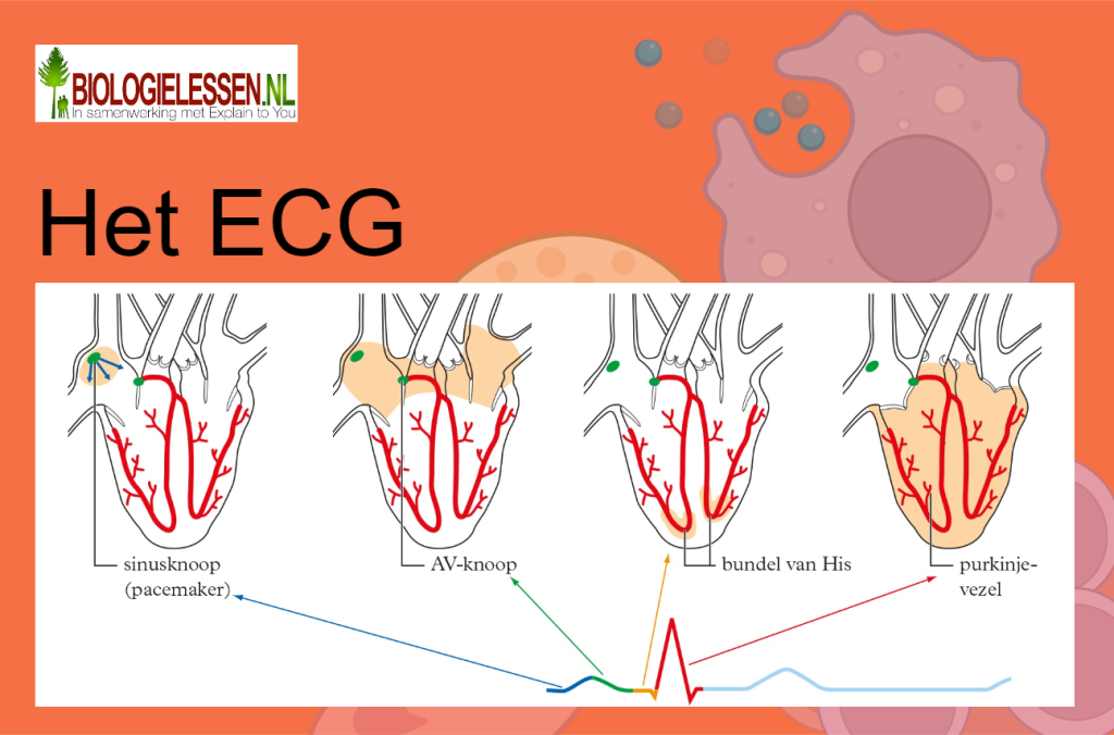 Het ECG