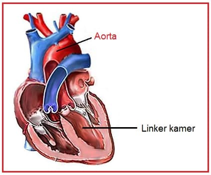 Aorta