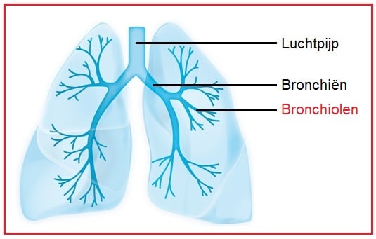 Bronchiolen