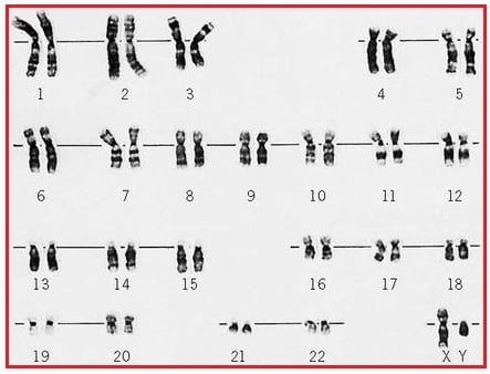 Caryogram