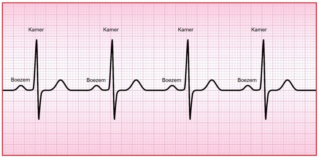 Hartslagfrequentie (Hf) 5 Hartrithme