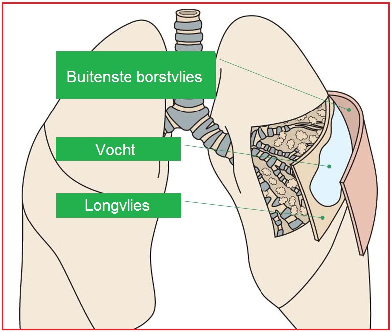 borstvlies