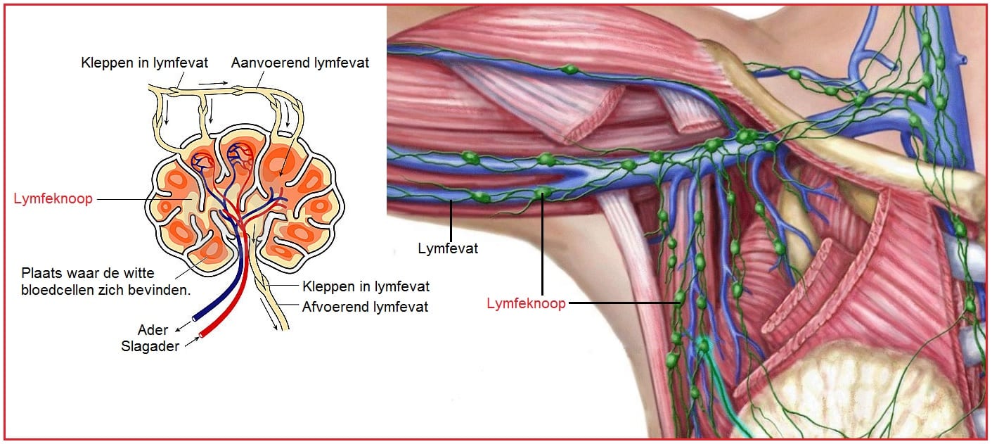 Lymfeknoop