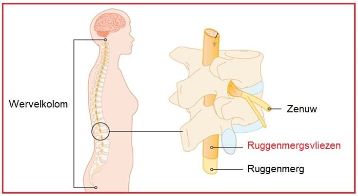 Ruggenmergsvliezen