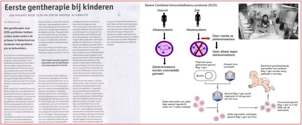 Eerste gentherapie bij kinderen 23 Eerste gentherapie bij kinderen