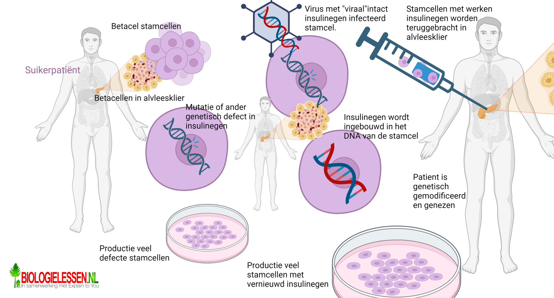 Diabetispatient wordt GGO