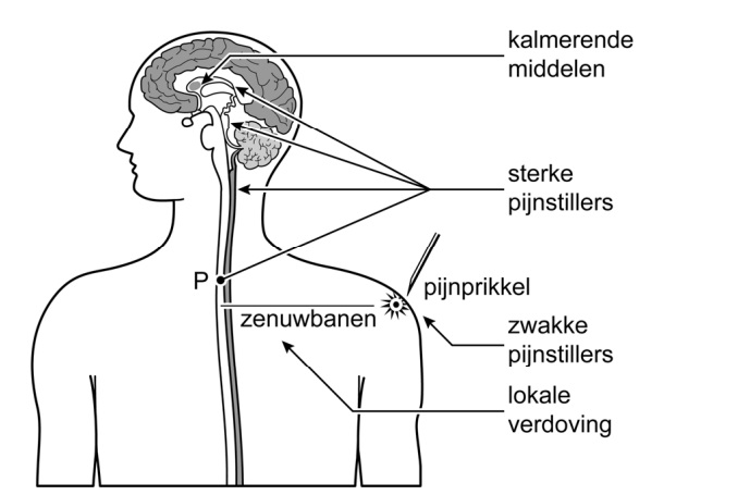 mavo hersenen