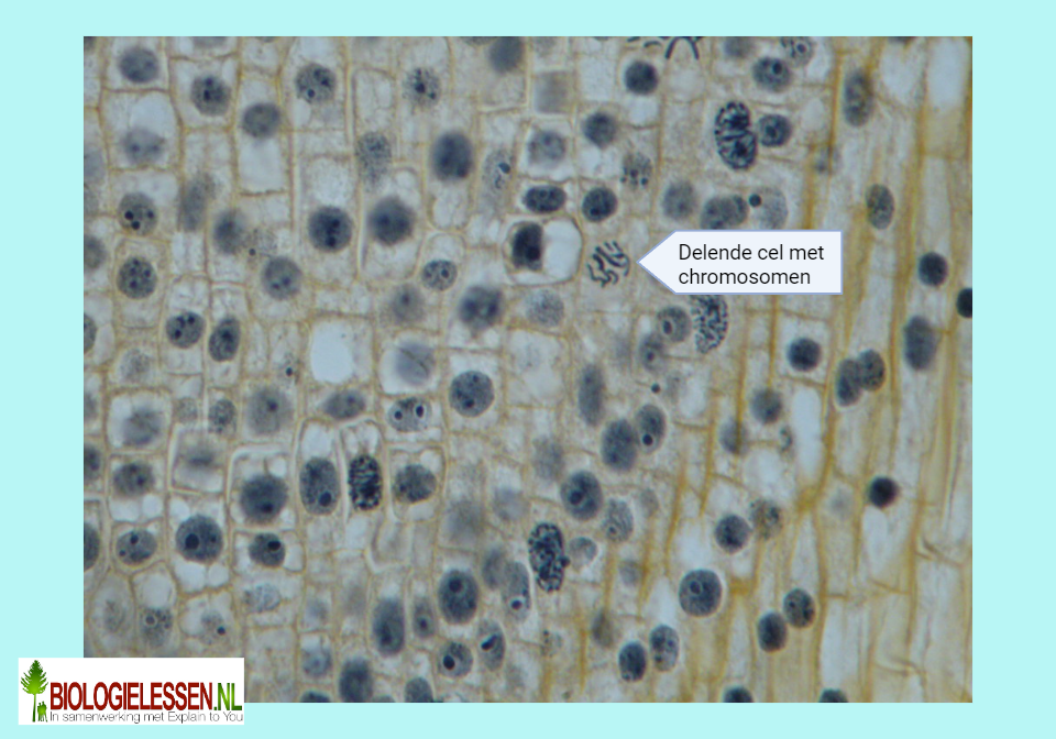 Delende cel met chromosomen