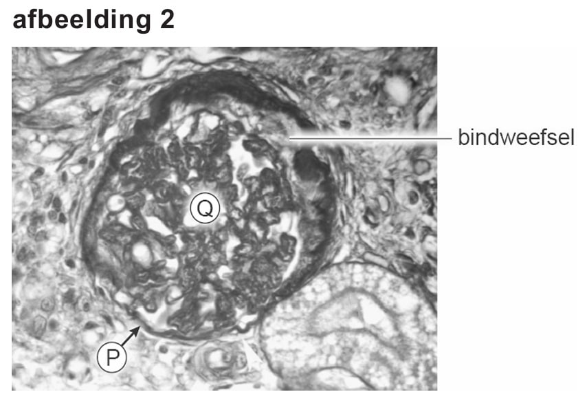 glomerulus 2